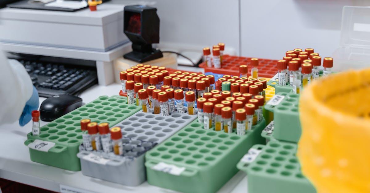 découvrez l'importance des diagnostics dans le domaine médical et technique. apprenez comment des évaluations précises peuvent améliorer la santé, optimiser les performances et prévenir les problèmes. explorez nos solutions et services de diagnostic adaptés à vos besoins.